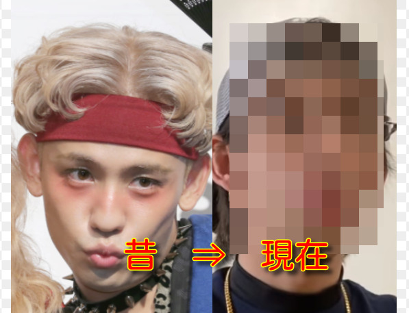 画像 りゅうちぇるの現在の姿が劣化して別人 昔と比較 仕事を干されても富裕層か ついでにアレコレわかるニュース 画像 りゅうちぇるの現在の姿が劣化して別人 昔と比較 仕事を干されても富裕層か ついでにアレコレわかるニュース